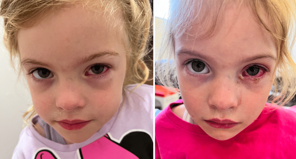 Aussie mum’s playground warning after 4-year-old child hospitalised