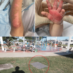 Aussie toddlers bloodcurdling screams after horrendous playground injury